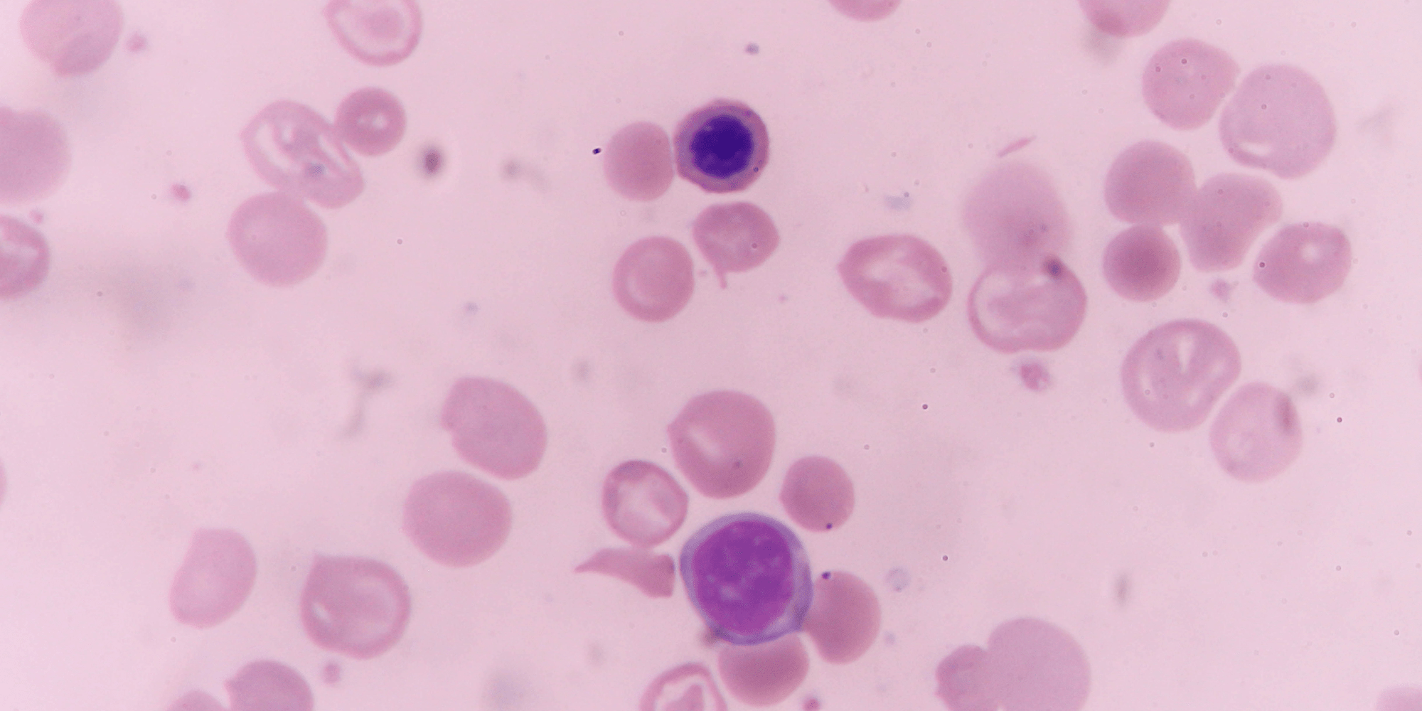 Staying Safe from Cyclospora While Eating Low-FODMAP - FODZYME